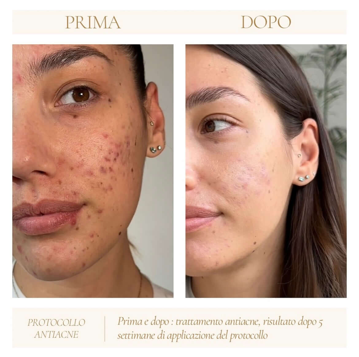 Crema pelle mista, grassa, antiacne • CLEANCORE | Coressence Calabria